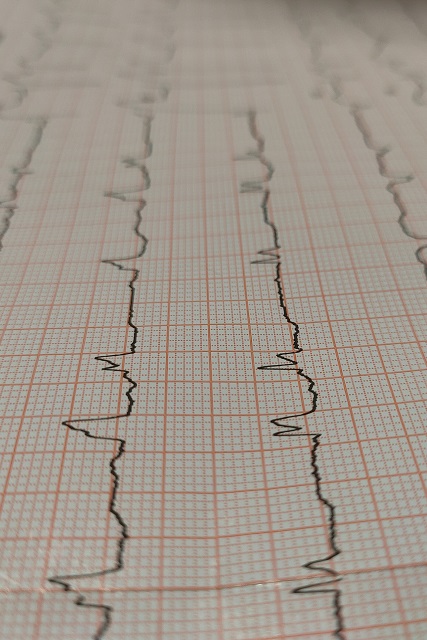 Профогляди